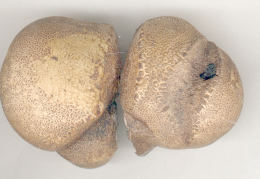 Scleroderma citrinum3
